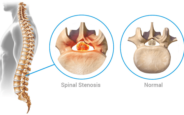 Back Pain - All The Causes and Symptoms | Dr. Thind